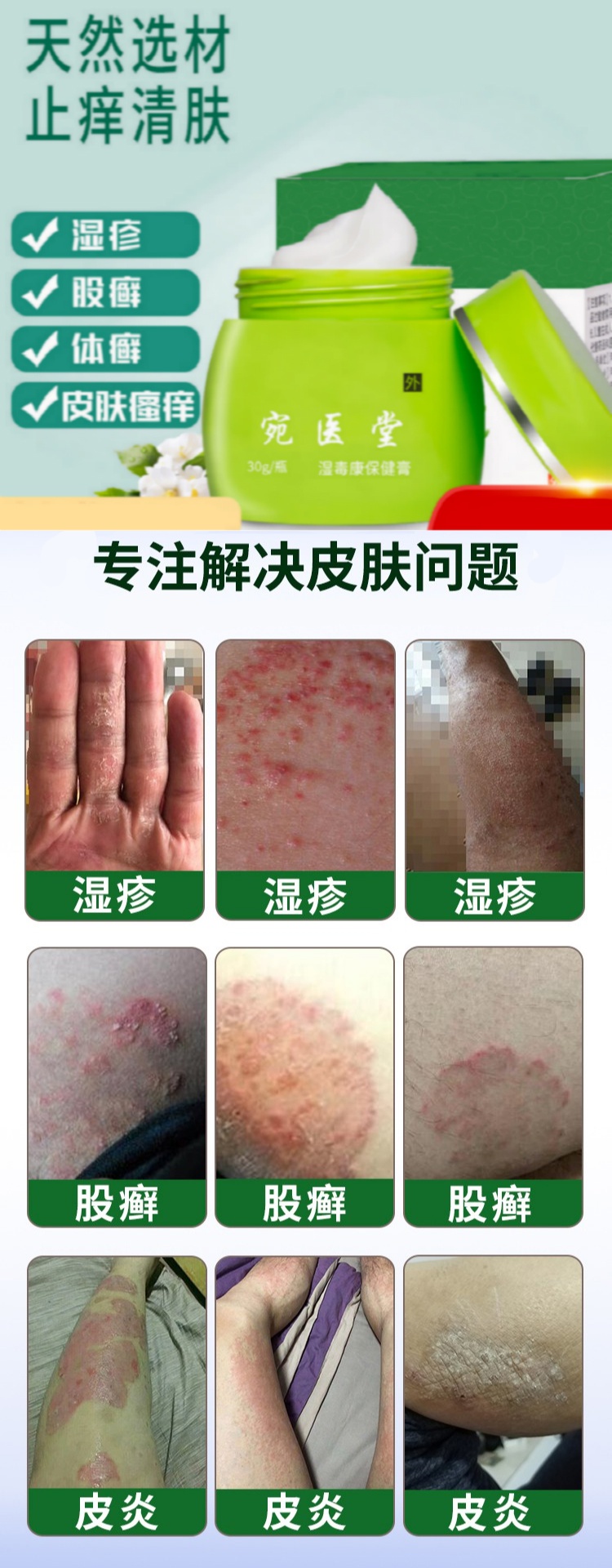 挠痒吧_挠痒