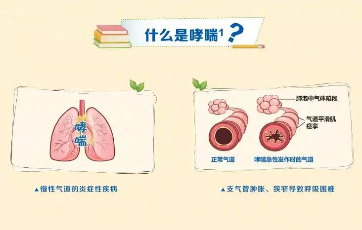 世界哮喘日_哮喘世界卫生组织数据_全世界哮喘人数