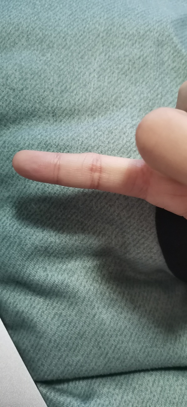 长期玩手游手指肿_手指头打游戏时管不管用_用手机玩游戏手指头肿了