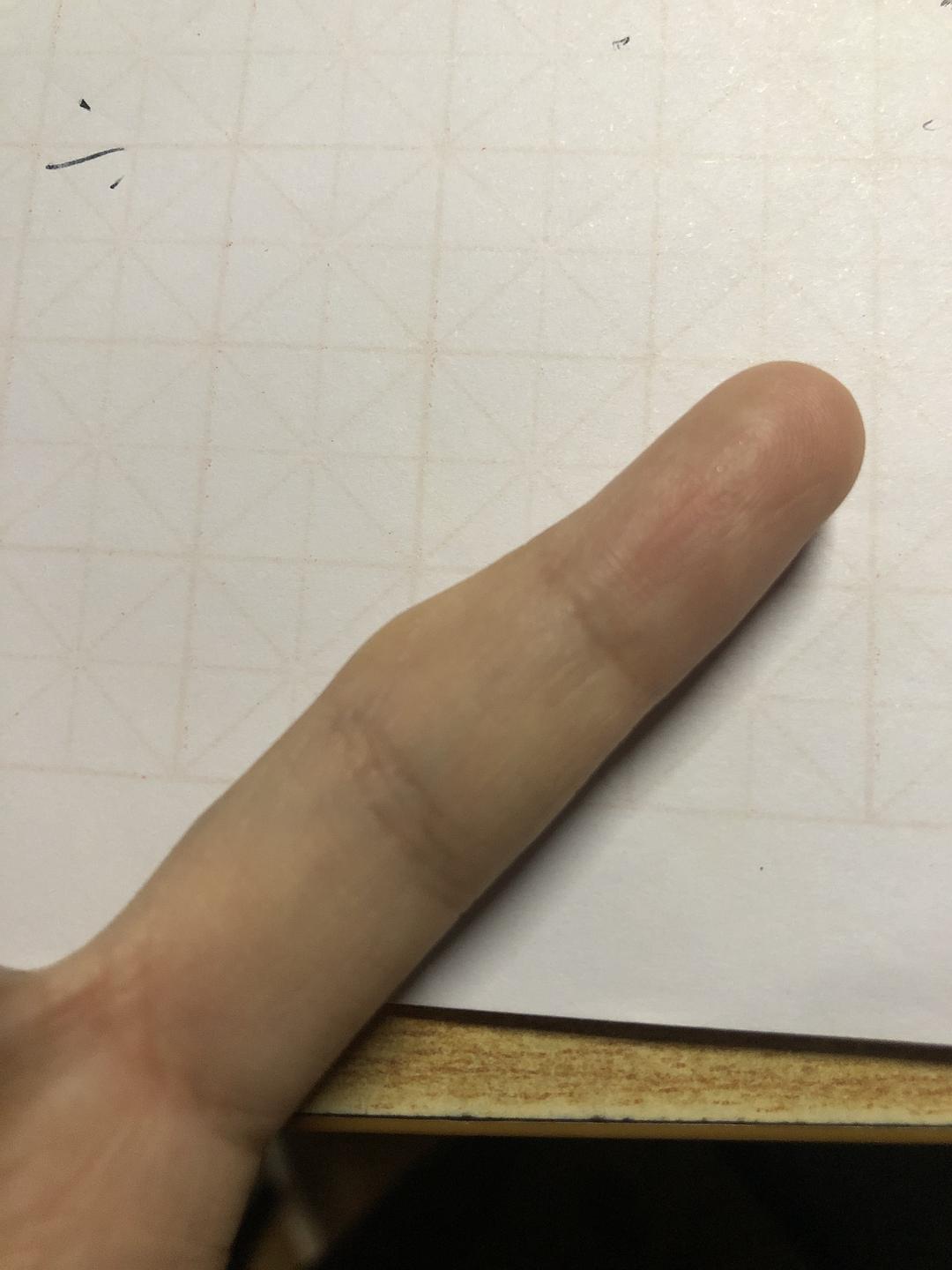 长期玩手游手指肿_用手机玩游戏手指头肿了_手指头打游戏时管不管用