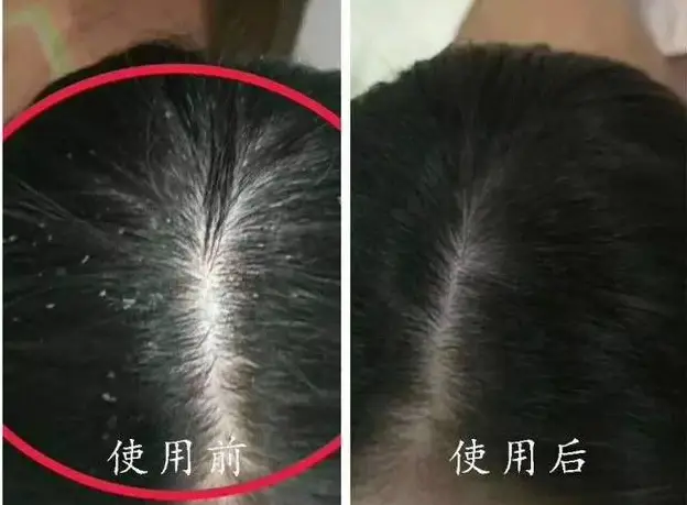 大寒之后养生注意什么呢_大寒之后冷多久_大寒之后